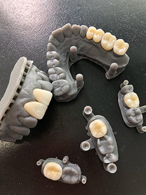 Melhorias Impressão 3D 