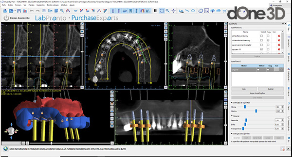 softwares de cad utilizados na odontologia