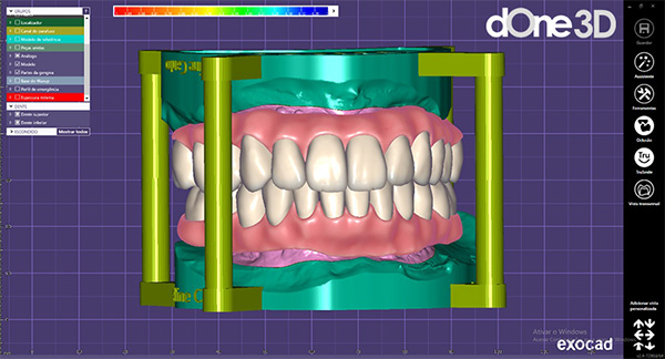 softwares CAD utilizados na odontologia