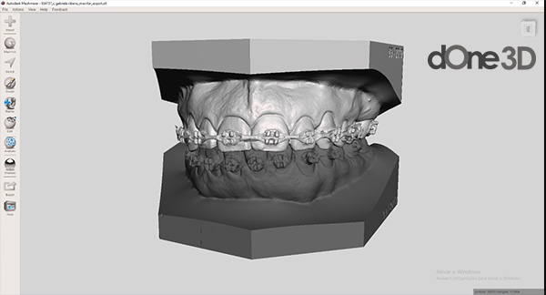 Softwares de cad utilizados na odontologia