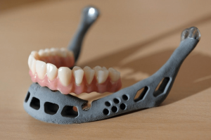 Rich result a primeira mandíbula impressa em 3d da história